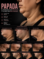 Masajeador Facial EMS Reductor de Papada | Definidor de Mandíbula en V | Lifting sin Cirugía